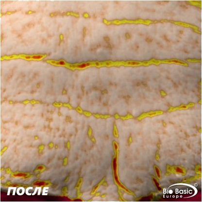 test crema dopo gotuage